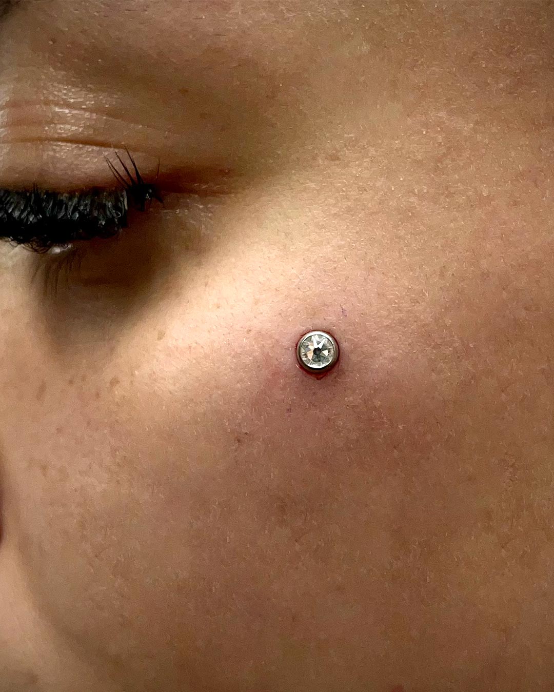 Piercing microdermal mejilla hecho por Iván